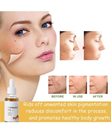 Turmeric Serum Turmeric Serum for Dark Spots Remover Turmeric Dark Spots Corrector Serum Oil for Face & Body Whitening Heals Scars Natural Whitening Serum Care Skin Care - Buy Online on GoSupps.com