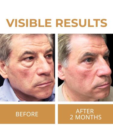 ABERA Natural Repair Eye Cream | Reduce Dark Circles Wrinkles & Puffiness | 0.5 fl oz - Buy Online on GoSupps.com