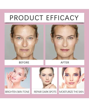 Dark Spot Correcting Glow Serum Dark Spot Corrector for Face Freckle Corrector Hyperpigmentation Treatment Skin Brightening Gel Cream for Sun Spots - Buy Online on GoSupps.com