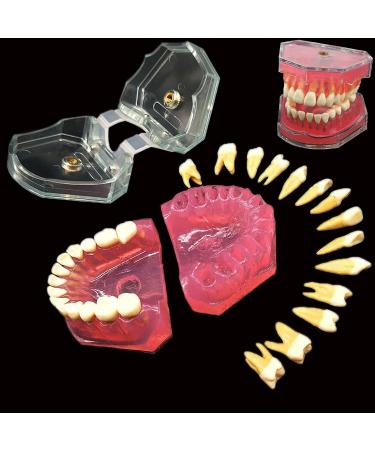 Dental Soft Gum Standad Typodont Study Model with 28 Removable Teeth & Cheeks - Ultimate Dental Training Tool - Buy Online on GoSupps.com