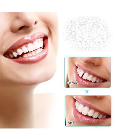 Buy Instant Smile Veneers - Top & Bottom False Teeth for a Perfect White Smile | Cosmetic Tooth Whitening Prosthetic Teeth - Buy Online on GoSupps.com