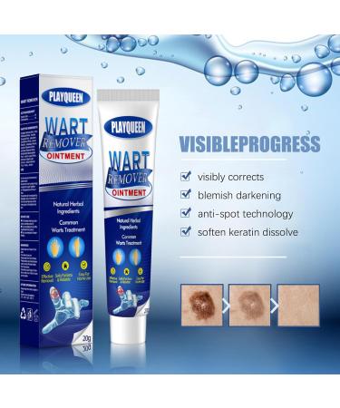 Fast Acting Wart Remover Ointment | Maximum Strength Wart Gel with Salicylic Acid | Effective Treatment for Common Plantar & Genital Warts - International Shipping Available - Buy Online on GoSupps.com