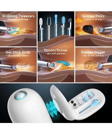 BEBIRD Home 30S Ear Care System - Advanced Ear Cleaner with FHD Camera & UVC Light | Complete Earwax Removal Kit for Adults & Kids - Buy Online on GoSupps.com