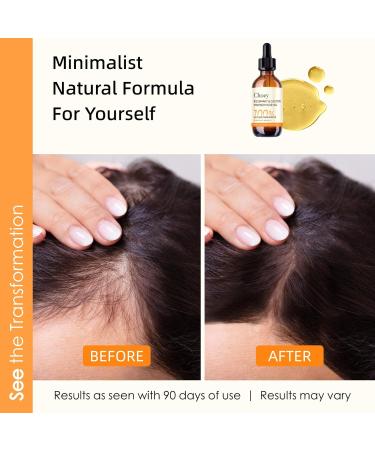 Organic Castor Oil & Rosemary Oil for Hair Growth | 2 Fl Oz | Vegan Scalp Treatment & Moisturizer for All Hair Types - Buy Online on GoSupps.com