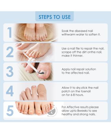 AUSLKA Toenail Fungus Treatment | Nail Renewal Solution for Discolored & Damaged Nails (32 Patches + 1 FL/OZ) - Fast & Easy Repair - Buy Online on GoSupps.com