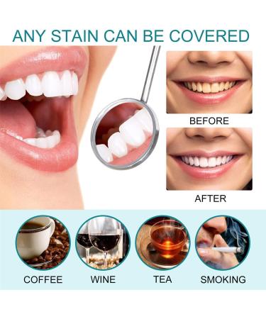 Immediate Tooth Whitening Gel - Safe & Effective Gentle Dental Polish for Sensitive Teeth | Power Tooth Color for Men & Women (1 Piece) - Buy Online on GoSupps.com