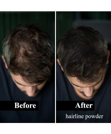 Leon Miguel Approach Powder - Waterproof Hair Concealer for Men & Women | Invisible Makeup for Hair Compression - Dark Brown 4G - Buy Online on GoSupps.com