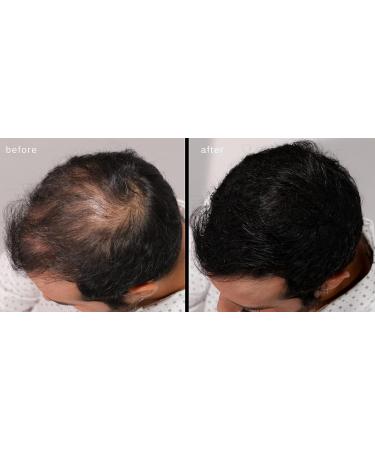 LUXE Hair Thickening Fibers - 2 Months+ Supply in Gray | Hypoallergenic & Dermatologist Tested for Confidence Boost - Buy Online on GoSupps.com