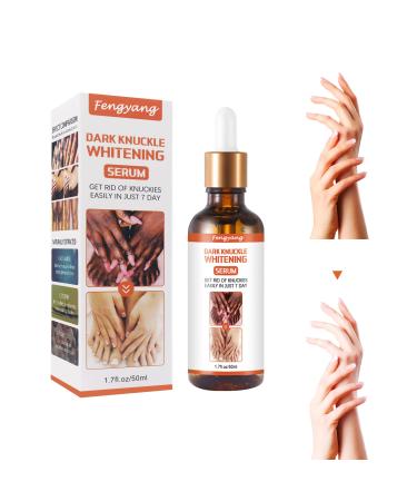 Fengyang Skin Whitening Serum Dark Knuckle Whitening Cream Dark Knuckle Whitening Serum Dark Knuckle Whitening Lotion Removing Dark Ankle Fingers