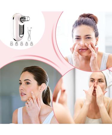 Facial Pore Remover | Blackhead Extractor - 3 Levels Of Suction White Spot Vacuum Extractor Use At Home Or In The Shower Women And Teens - Buy Online on GoSupps.com