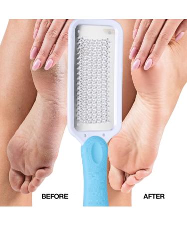 Foot File Feet Hard Skin Remover Foot Scraper Foot Files Foot Grater Foot exfoliator for Wet Dry Dead Rough Skin Dry Cracked Feet Foot Care - Buy Online on GoSupps.com
