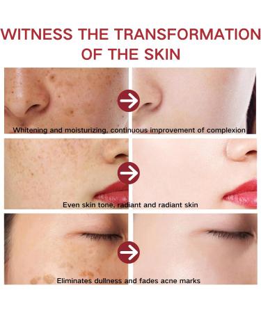 Brightening Face Cream - Moisturizer for Women - Dark Spot Remover for Women - Face Moisturiser for Dry Skin - Deeply Nourishes and Moisturise Skin - Skin Lightening Cream - Buy Online on GoSupps.com