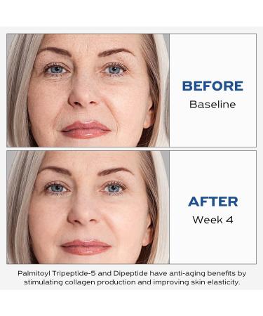 IGAME Polypeptide Firming Cream - Enhance Skin Elasticity Improve Barrier Sensitive Skin - 1.7 Fl.Oz - Buy Online on GoSupps.com