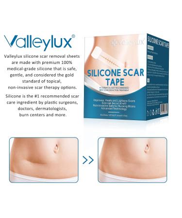 Silicone Scar Sheets 1.5x60 Tape Roll for C-Section Tummy Tuck Keloid Acne Removal - Post Surgery Treatment - Buy Online on GoSupps.com
