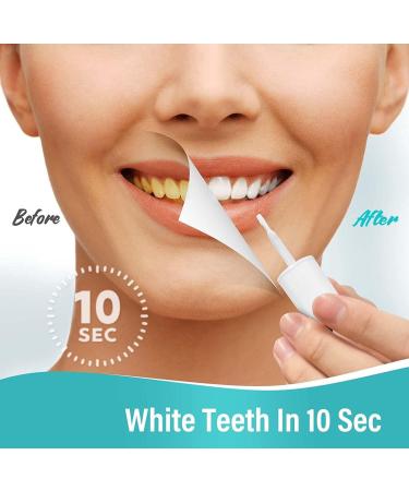 Tooth Paint - 15ml Instant Teeth Whitening Gel | 3Pcs Color Correcting Tooth Stain Remover - Buy Online on GoSupps.com