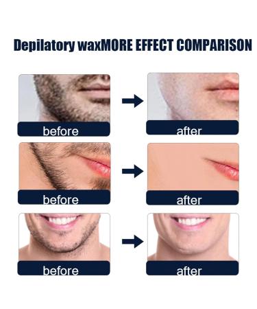 30 Tackable Beeswax Hair Removal Strips - Facial Wax Strips for Men | Effective Ingrown Hair Solution | International Shipping - Buy Online on GoSupps.com