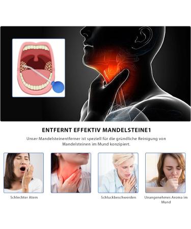 Premium Tonsil Stone Remover Tool Set | Cupping Glass & Tooth Mirror | Effective Solution for Bad Breath & Oral Care - Buy Online on GoSupps.com