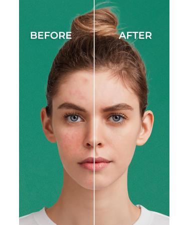 Sinoz Pure Cica Color Correcting Treatment Fluid Sunscreen SPF50+ / PA++++ - Buy Online on GoSupps.com