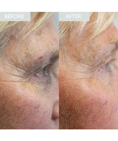 SKINICIAN Ageless Peptide Eye Complex - Anti-Wrinkle Eye Cream with Hyaluronic Acid & Vitamin C - Peptide Serum Eye Cream for Dark Circles - Stimulate Collagen Product - Vegan & Cruelty Free (15ml) - Buy Online on GoSupps.com