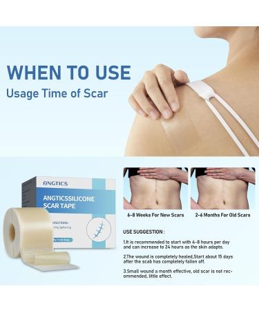 Medical Grade Silicone Scar Sheets - Reusable Silicone Gel Tape for Surgical Scars C-Section Burns & Acne - 1.6 x 150 Roll (3.8M - Buy Online on GoSupps.com