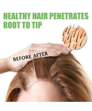 Essential Oil for Hair Density & Growth - 30ml Aibyks Natural Wild Hair Growth Oil - Buy Online on GoSupps.com