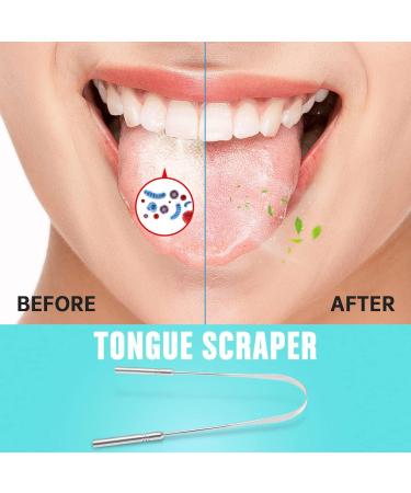 Premium Stainless Steel Tongue Cleaner Set (2 Pieces) - Antimicrobial Design for Fresh Breath | Durable Tongue Scraper | Silver Gray - Buy Online on GoSupps.com
