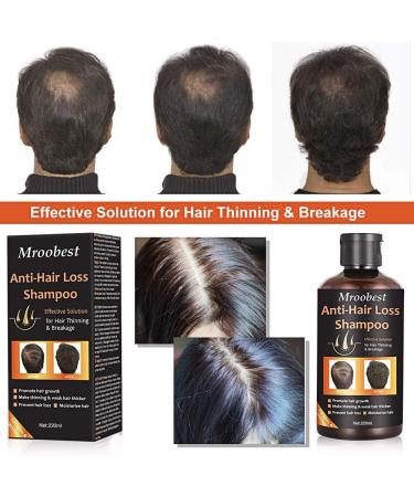 Ginger Hair Growth Shampoo & Conditioner Set | Anti Hair Loss, Promotes Fast Hair Growth, Moisturizes & Strengthens Thin/Damaged Hair - 14.67 oz - Buy Online on GoSupps.com
