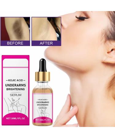 Kojic Underarms Brightening Serum Kojic Whitening Brightening Moisturizing And Revitalizing Skin Mild Ingredients Lightening Serum for intimate parts armpits and intimate parts 30ml (2pc) - Buy Online on GoSupps.com
