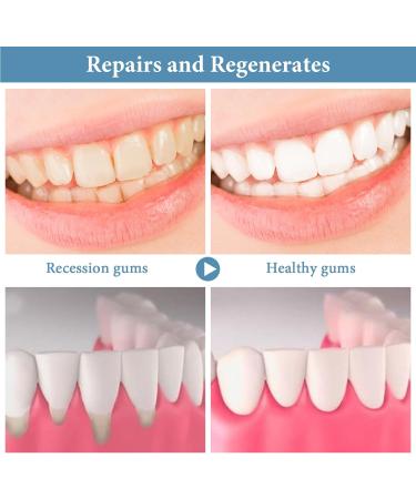 wimony Neslemy Gum Shield Therapy Gel Dentizen Gum Therapy Gel Gum Repair Treatment Gel Instant Teeth Whitening Essence Pen Deeply Cleaning Gums Teeth Whitening Enhances Overall Gum Health (4pcs) - Buy Online on GoSupps.com