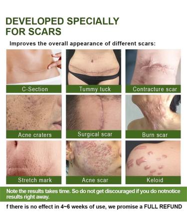 Goopgen Advanced Scar Repair Serum - Medical Grade Treatment for All Types of Scars - Moisturizing and Skin Smoothing Formula - 1 Pc - Buy Online on GoSupps.com