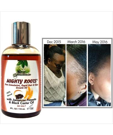 Fountain Mighty Roots Organic Edge Growth Treatment Jamaican Black Castor & Pimento Oil Satin Cap 4 oz - Boost Hair Growth Up to 3x - Buy Online on GoSupps.com