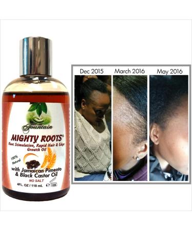 Fountain Mighty Roots - Jamaican Pimento & Black Castor Hair Loss Treatment - 3 Pack - Buy Online on GoSupps.com