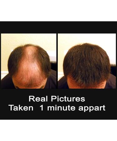 Buy Black 100g Super Size Original Samson Hair Building Fibers Refill - Enhance Your Hair Today - Buy Online on GoSupps.com