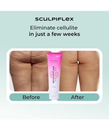 Sculpiflex Anti Cellulite Cream, Lifting and Firming Body Cream for Arms, Stomach, and Legs, Smoothing and Hydrating for Soft, Toned Skin, Lightweight, Suitable for All Skin Types (2.82oz) - Buy Online on GoSupps.com