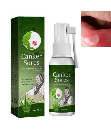 Spray de Soulagement Ulc res Spray Pour Ulceres Buccaux Spray Soins Ulc res Buccale Spray de Soulagement Ulc res Buccaux Traitement des Ulc res de la Bouche Spray Contre Ulc re Buccal 1PC