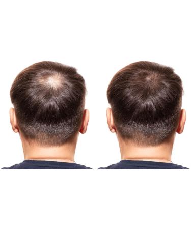 Oil Haven Rosemary Oil - 100ML Pure and Natural Premium Quality Oil for Hair Growth, Strengthening, and Dandruff Prevention - Organic Therapeutic Grade - Buy Online on GoSupps.com