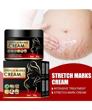 Cr me pour varices limination des varices r parateur de varices cr me pour varices jambes varices enflamm es 20 g 1 pi ce - Buy Online on GoSupps.com