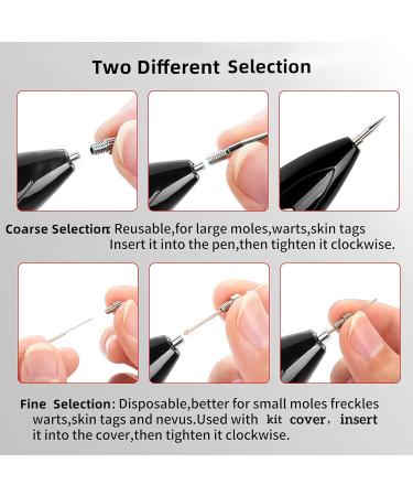 CHRERNA Skin Tags & Mole Removal Kit - 9 Modes Plasma Pen for Warts, Spots, Body & Facial Nevus - Buy Online on GoSupps.com