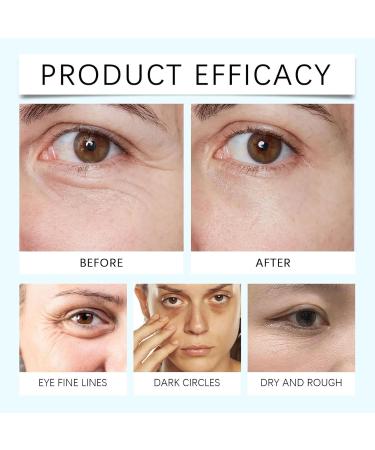 Under Eye Cream For Dark Circles And Puffiness Caffeine Eye Cream Anti Aging Brightener With Niacinamide Peptide Complex Korean Skin Care Formula Eye Cream Massage Zinc Roller Puffy Eyes (2) - Buy Online on GoSupps.com