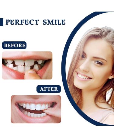 Buy Temporary Fake Teeth for Men & Women | Comfortable Cosmetic Denture Veneers for Upper & Lower Jaw - Regain Your Confident Smile - Buy Online on GoSupps.com