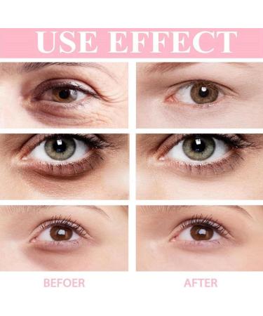 Retinol Eye Stick Under Eye Balm Stick Retinol Eye Cream Eye Balm Stick Retinol Correction Eye Cream Eye Cream Anti Aging Wrinkle Stick For All Skin Types Under Eye Cream Eye Brightener Stick - Buy Online on GoSupps.com
