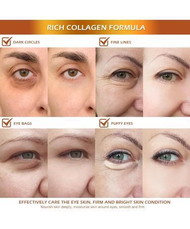 SDSM 24k Gold Under Eye Collagen Mask Patches 5X Anti Wrinkle Moisturizing and Repairing Ability Reduce Puffy Eyes & Dark Circle Under Eye Gel Patches Smooth Tired Eye Masks - (Jar - 30 Pair) - Buy Online on GoSupps.com