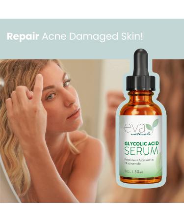 Eva Naturals Glycolic Acid Serum - Anti-Aging Vitamin C & Hyaluronic Acid - Minimize Pores, Reduce Fine Lines & Wrinkles, Acne Scarring - 1 Oz - Buy Online on GoSupps.com