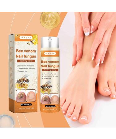 Bee Venom Nail Fungus Soothing Spray - Extra Strength Toenail Treatment (20ml) | Natural Nail Fungus Relief - Buy Online on GoSupps.com