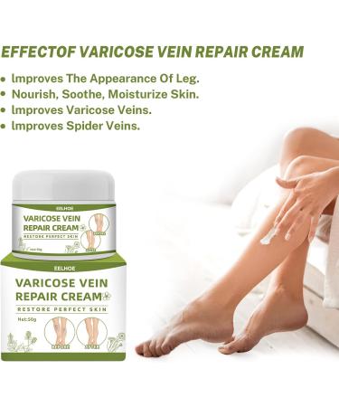 Varices Cr me Cr me de Traitement Des Veines D'araign e pour Les Jambes Cr me pour Les Jambes Soulage Rapidement Les Jambes Fatigu es Et Lourdes - Buy Online on GoSupps.com