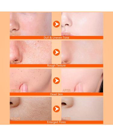 Keratin Care Turmeric Spray Gently Exfoliating Body & Face Peel Spray with Retinol Turmeric Niacinamide Moisturizing & Hydrating Skincare for All Skin Types 100ml 3.38 Fl Oz (Pack of 1) - Buy Online on GoSupps.com