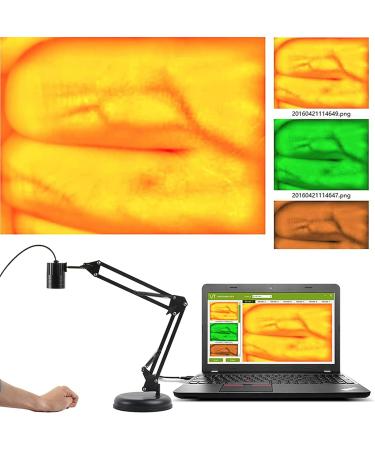 Adjustable Vein Viewers for Nurses | USB Camera Imaging IV for Accurate Venous Access | Ideal for Adults | Enhance Vein Puncture Success - Buy Online on GoSupps.com
