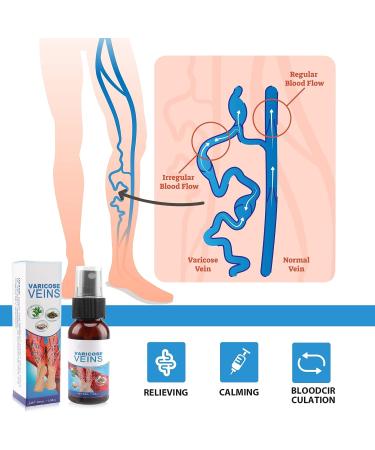 3Pcs Varicose Veins Treatment Set - Heal Veins, Improve Circulation - 90ml Spray - Buy Online on GoSupps.com