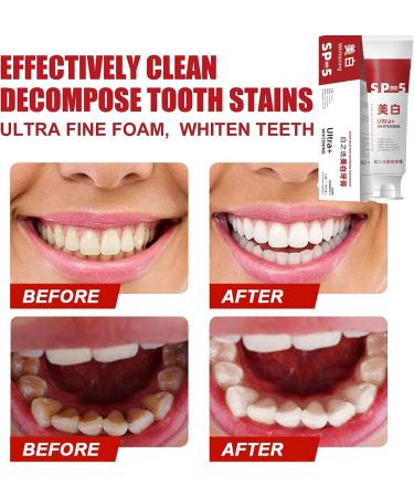 Sp-5 Toothpaste Sp 5 Teeth Whitening Toothpaste Sp-5 Ultra Whitening Toothpaste Sp-5 Probiotic Shark Whitening Toothpaste Stain Removal Toothpaste Fresh Breath Toothpaste - Buy Online on GoSupps.com