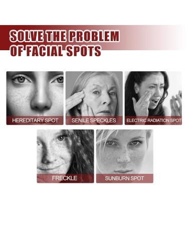 Whitening Spot Lightening Cream - Brighten & Exfoliate Skin Tone | Moisturizing Facial Repair Cream Type 3 - Buy Online on GoSupps.com